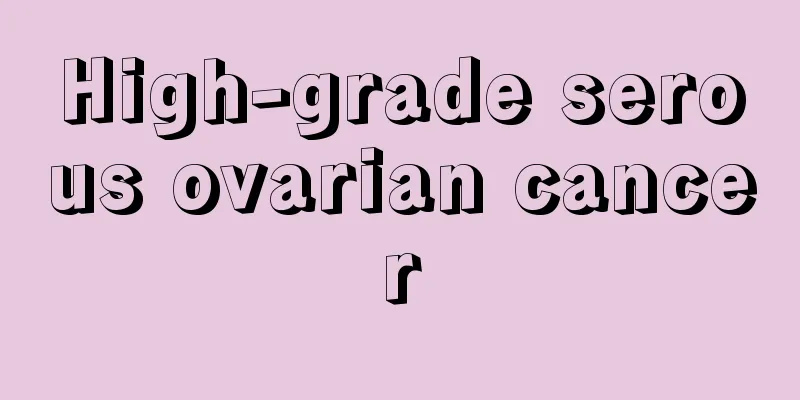 High-grade serous ovarian cancer