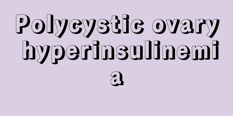 Polycystic ovary hyperinsulinemia