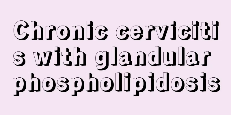 Chronic cervicitis with glandular phospholipidosis