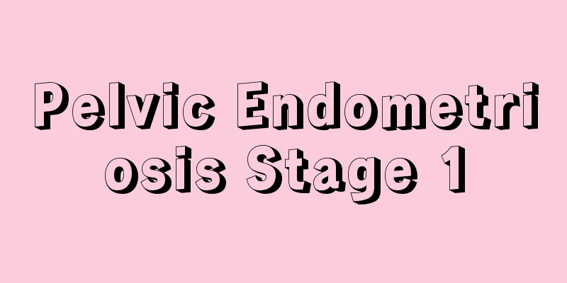 Pelvic Endometriosis Stage 1