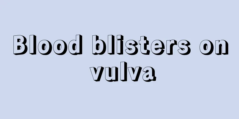 Blood blisters on vulva