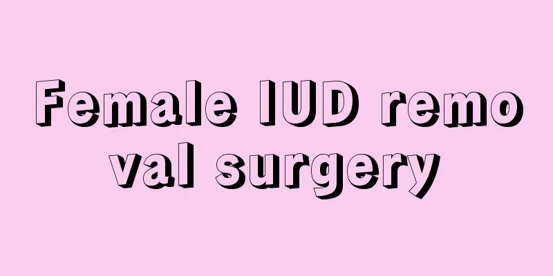 Female IUD removal surgery