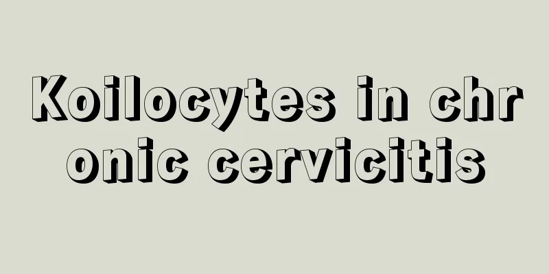 Koilocytes in chronic cervicitis