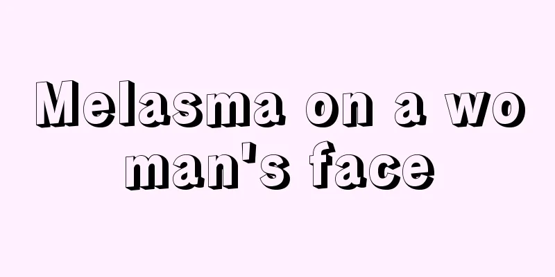 Melasma on a woman's face