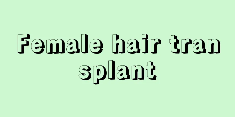 Female hair transplant