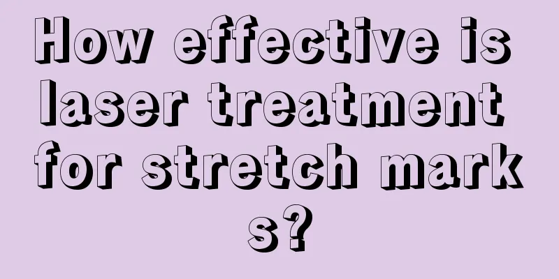 How effective is laser treatment for stretch marks?