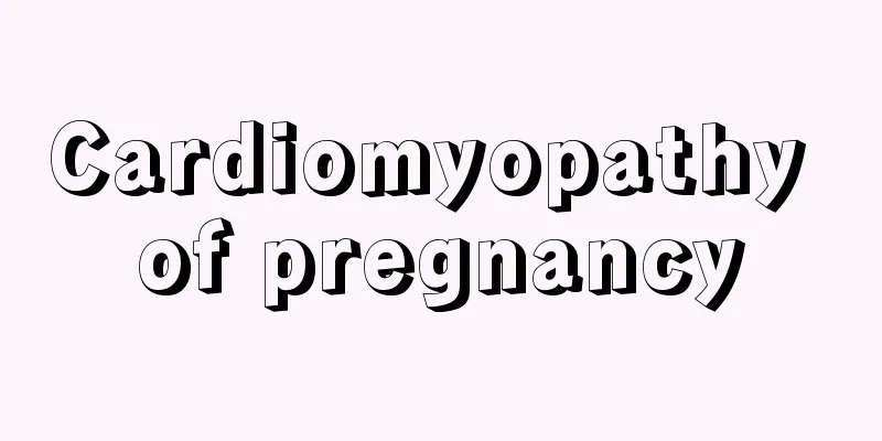 Cardiomyopathy of pregnancy