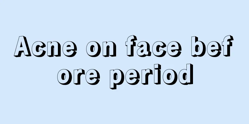 Acne on face before period