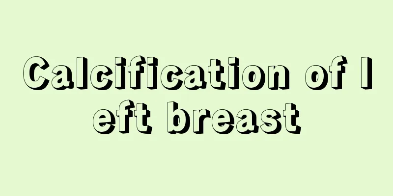 Calcification of left breast