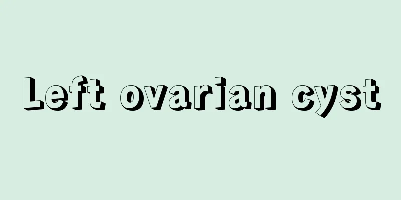 Left ovarian cyst