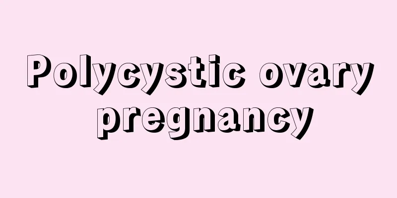 Polycystic ovary pregnancy