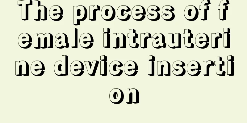 The process of female intrauterine device insertion