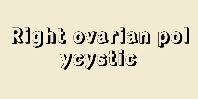 Right ovarian polycystic