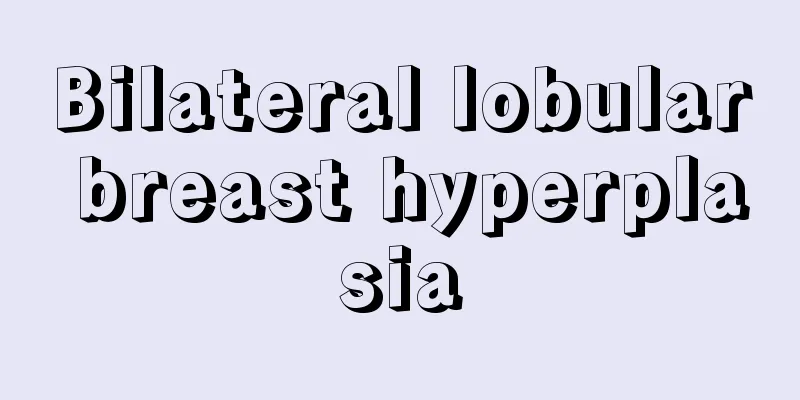 Bilateral lobular breast hyperplasia