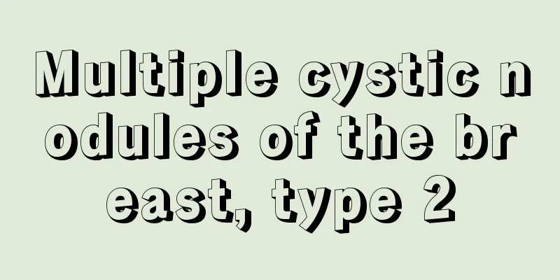 Multiple cystic nodules of the breast, type 2