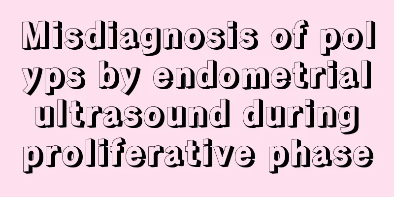 Misdiagnosis of polyps by endometrial ultrasound during proliferative phase