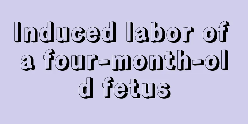 Induced labor of a four-month-old fetus