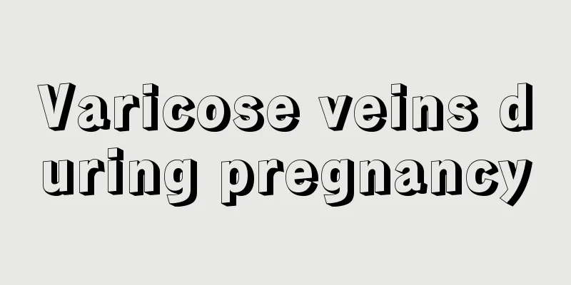 Varicose veins during pregnancy