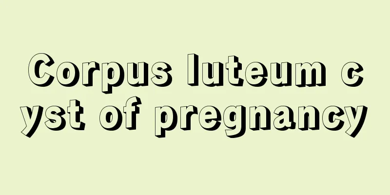 Corpus luteum cyst of pregnancy