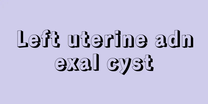 Left uterine adnexal cyst