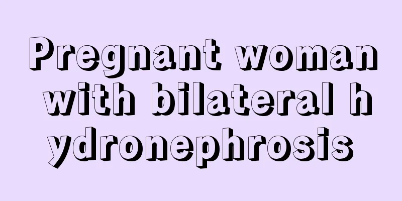 Pregnant woman with bilateral hydronephrosis