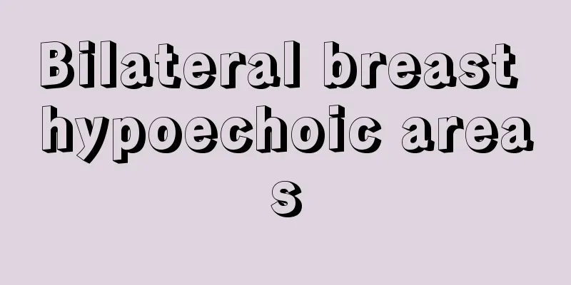 Bilateral breast hypoechoic areas