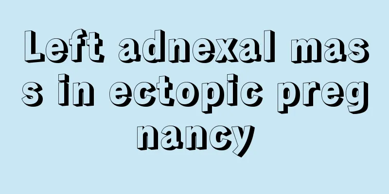 Left adnexal mass in ectopic pregnancy