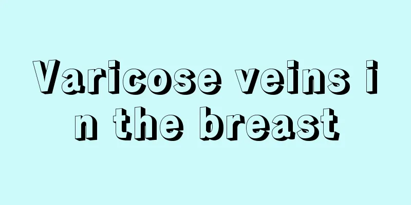 Varicose veins in the breast