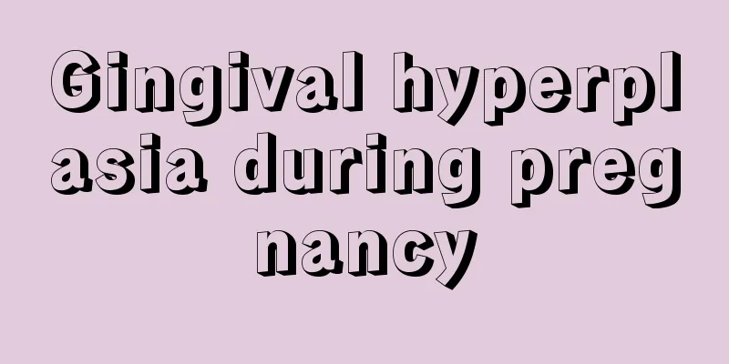 Gingival hyperplasia during pregnancy