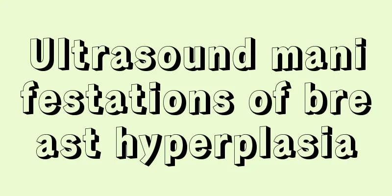 Ultrasound manifestations of breast hyperplasia