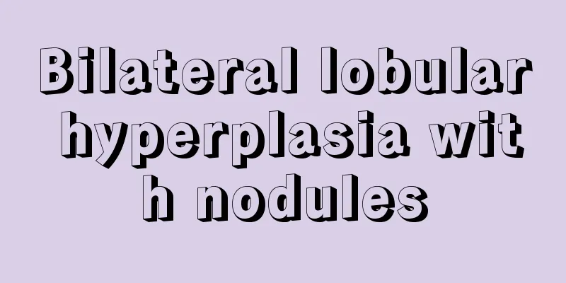 Bilateral lobular hyperplasia with nodules