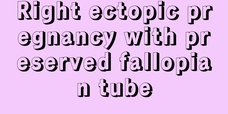 Right ectopic pregnancy with preserved fallopian tube