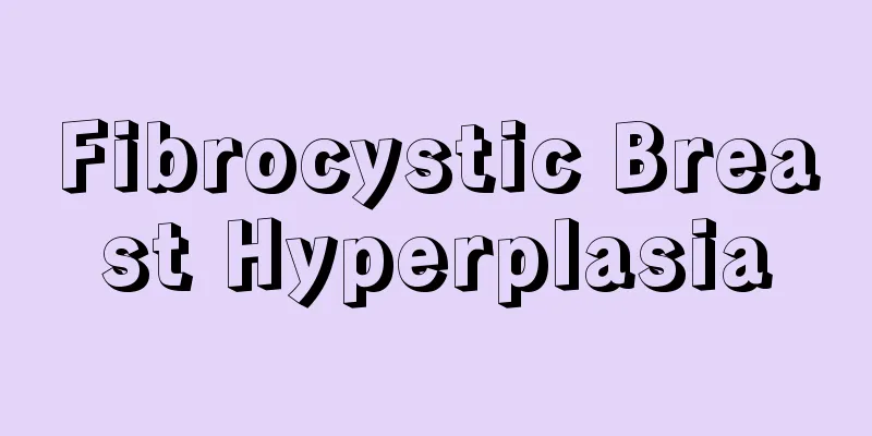 Fibrocystic Breast Hyperplasia