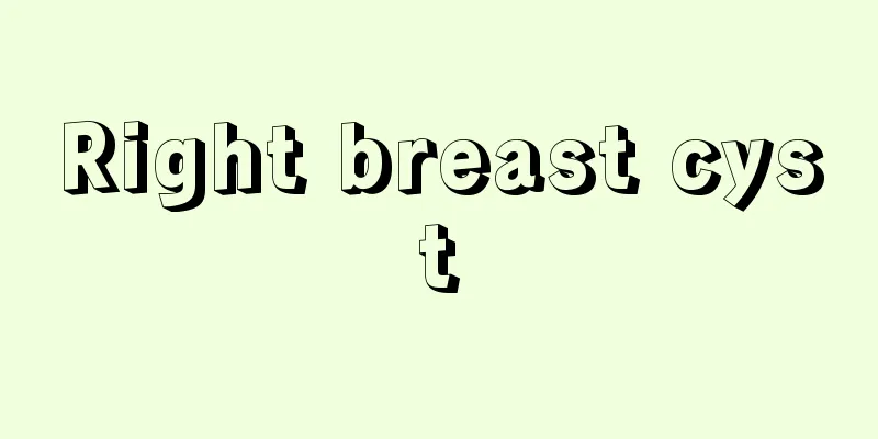 Right breast cyst