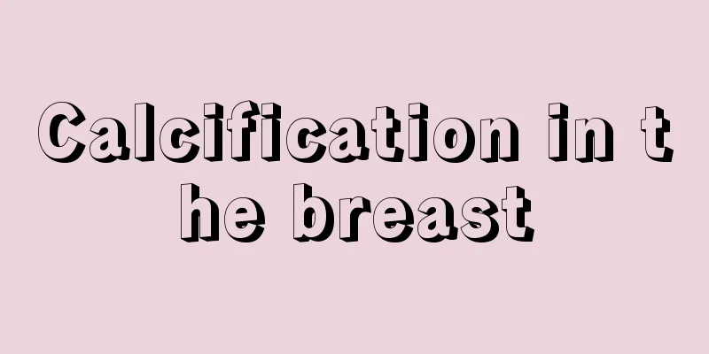 Calcification in the breast