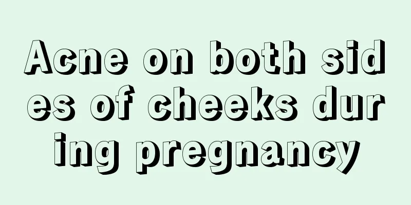 Acne on both sides of cheeks during pregnancy