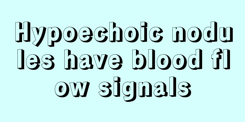 Hypoechoic nodules have blood flow signals