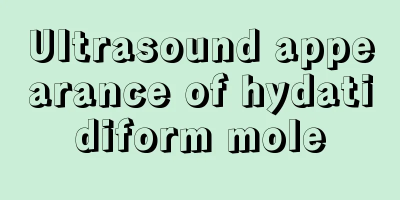 Ultrasound appearance of hydatidiform mole