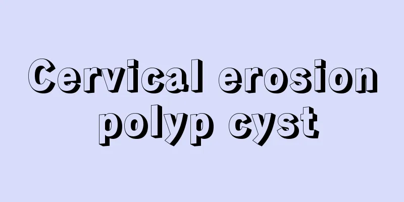 Cervical erosion polyp cyst