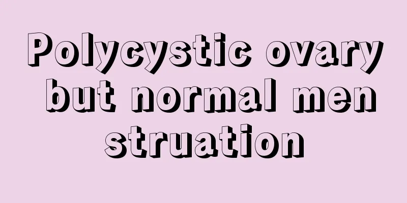 Polycystic ovary but normal menstruation