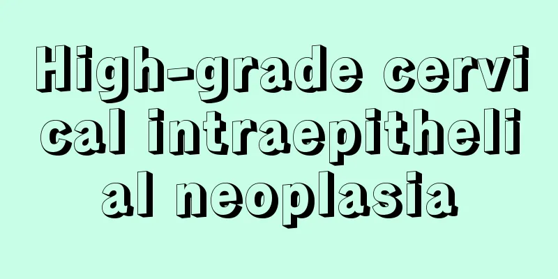 High-grade cervical intraepithelial neoplasia