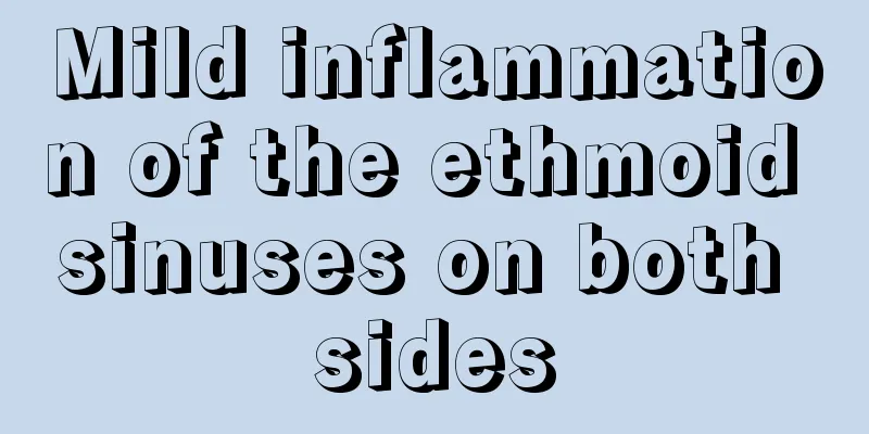 Mild inflammation of the ethmoid sinuses on both sides