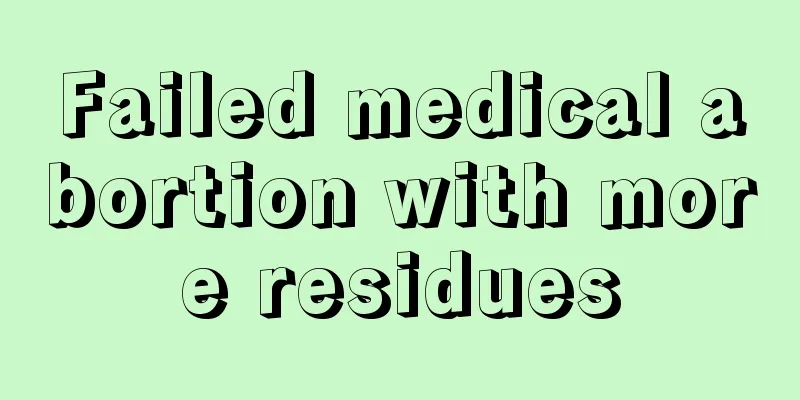 Failed medical abortion with more residues