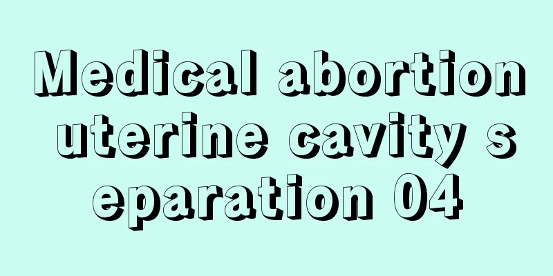 Medical abortion uterine cavity separation 04