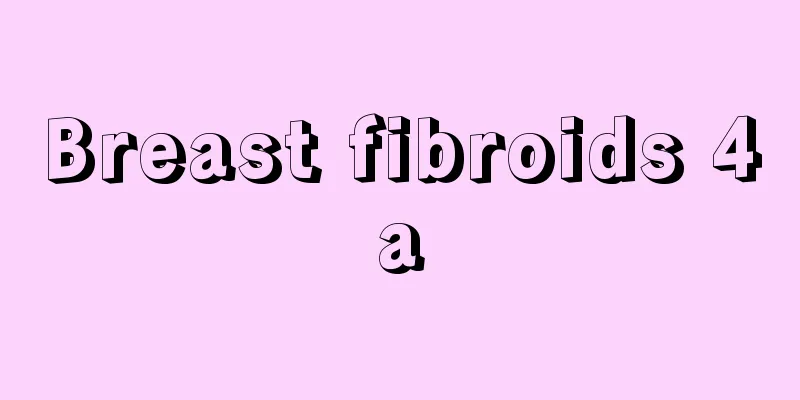 Breast fibroids 4a