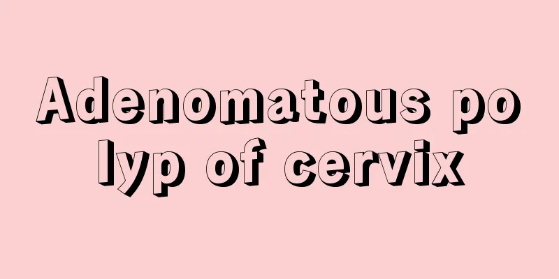 Adenomatous polyp of cervix