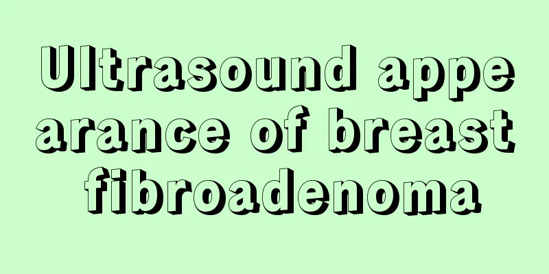 Ultrasound appearance of breast fibroadenoma