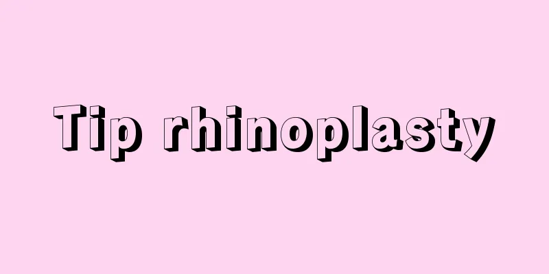 Tip rhinoplasty