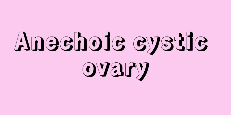 Anechoic cystic ovary