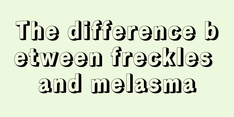 The difference between freckles and melasma